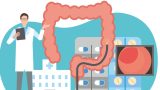 「大腸カメラ」は何歳から？ 『血便』や『腹痛』前に行うべき理由【医師解説】