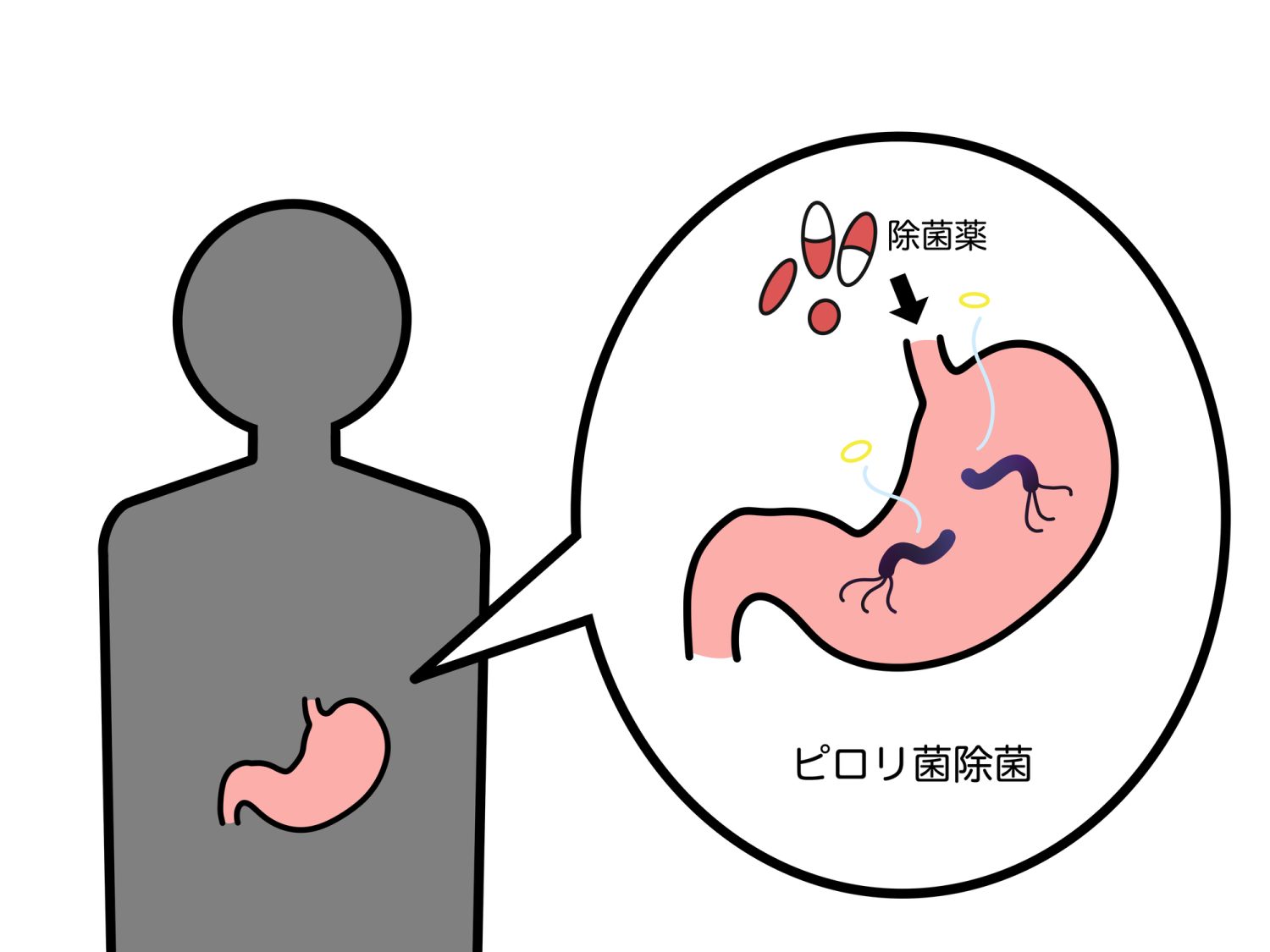 除菌すれば安心ではない理由