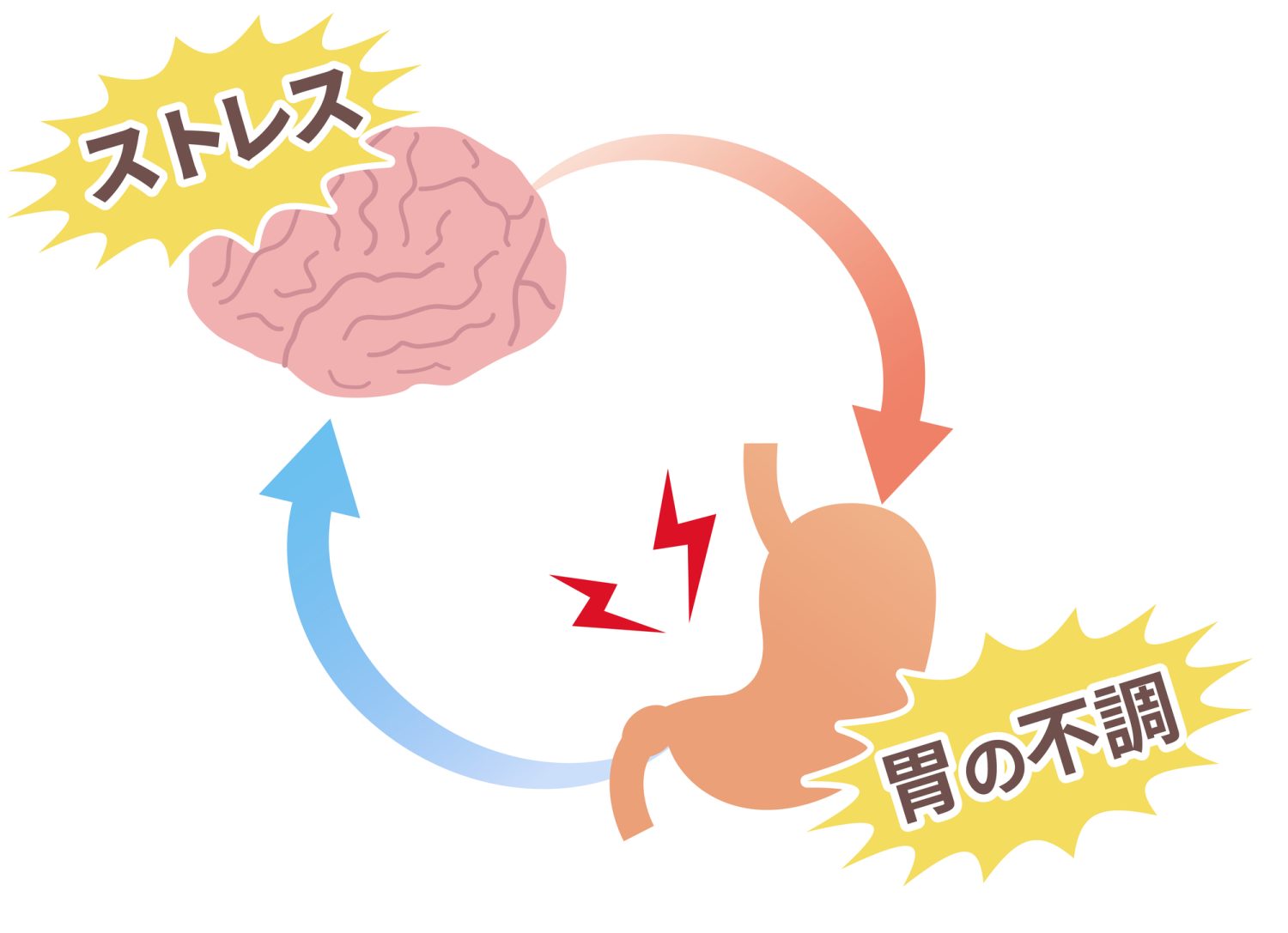 機能性消化管障害の主な種類とメカニズム