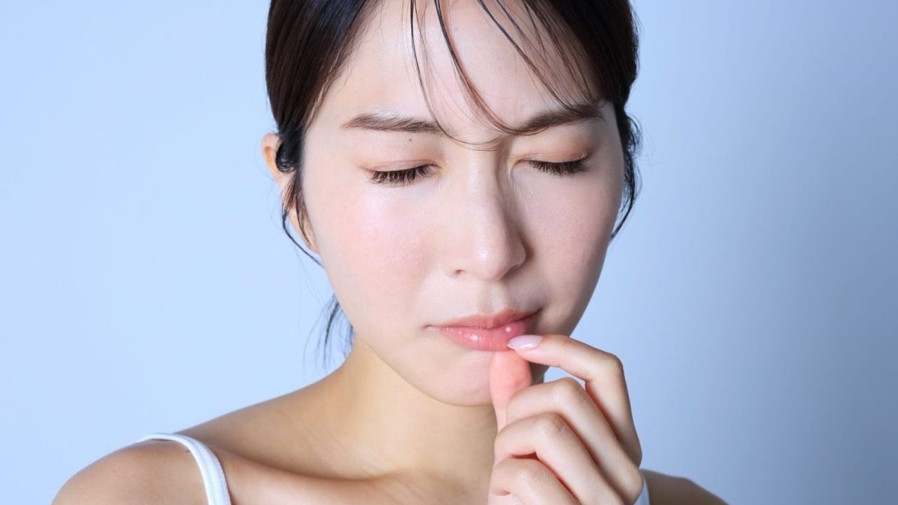 【闘病】「ただの口内炎」が一転、『舌がん』に。消えない再発の恐怖と闘う40代母