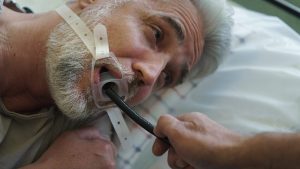 「内視鏡検査」は痛いって本当？ 『胃がん』早期発見へ向けた苦痛の少ない受け方