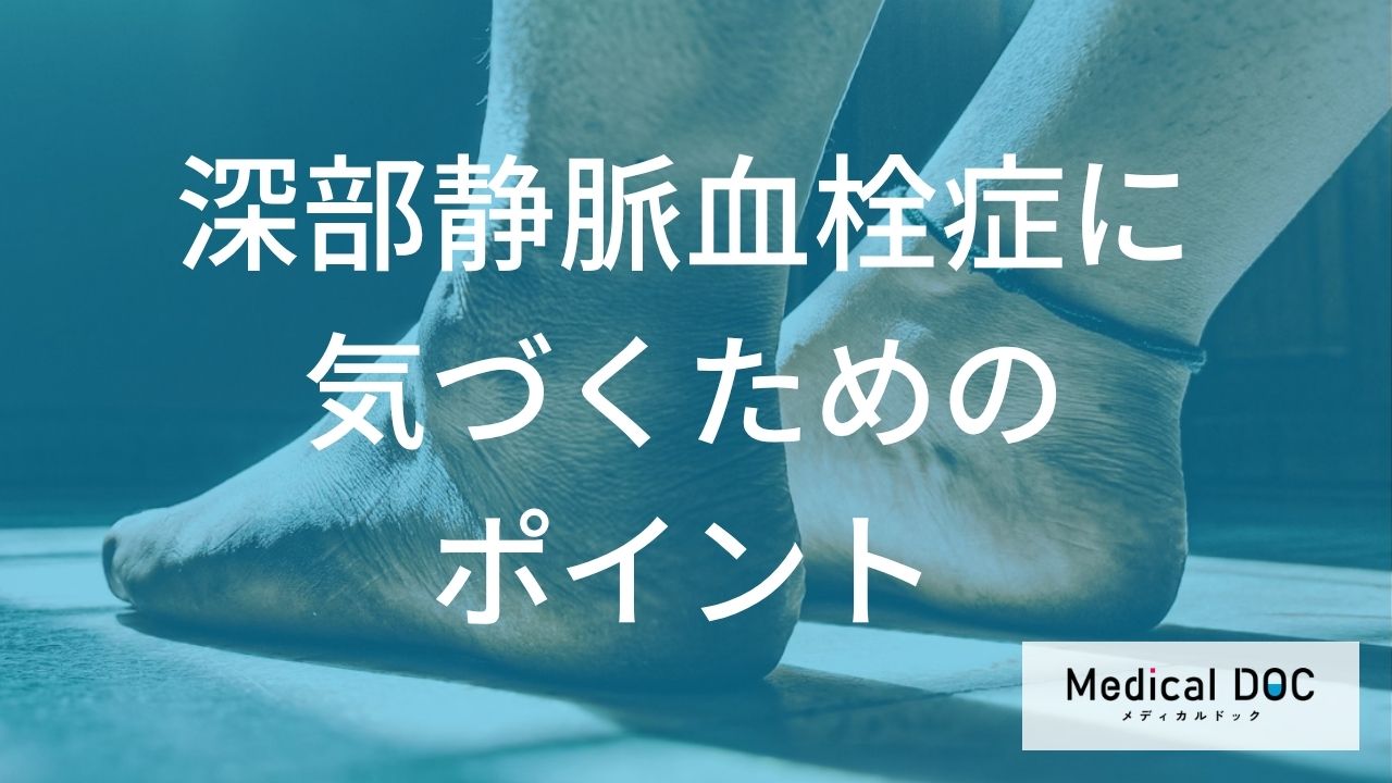 長時間座った後の“何”に注意すべき？「深部静脈血栓症」を見逃さない観察ポイントを医師が解説
