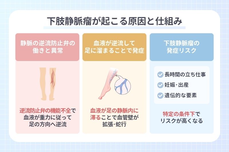 下肢静脈瘤が起こる原因と仕組み
