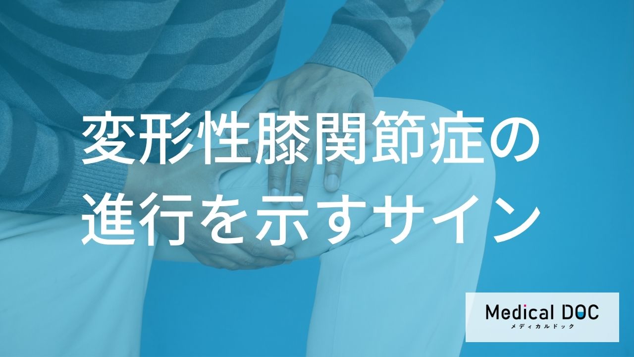 膝が曲がりにくいのは「骨のトゲ」が原因かも？ 変形性膝関節症の進行を遅らせる日常生活の工夫
