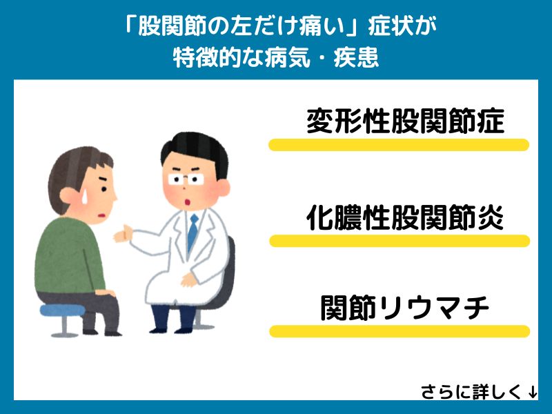 「股関節の左だけ痛い」症状が特徴的な病気・疾患