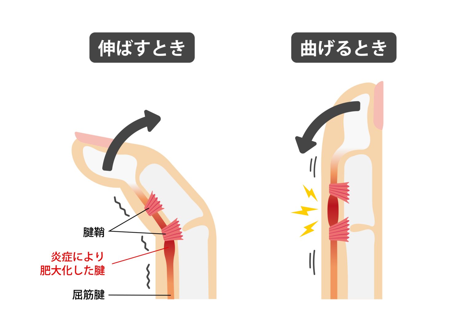 手術はどのような方法で行うのか？