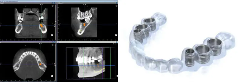 赤坂さくら歯科クリニック