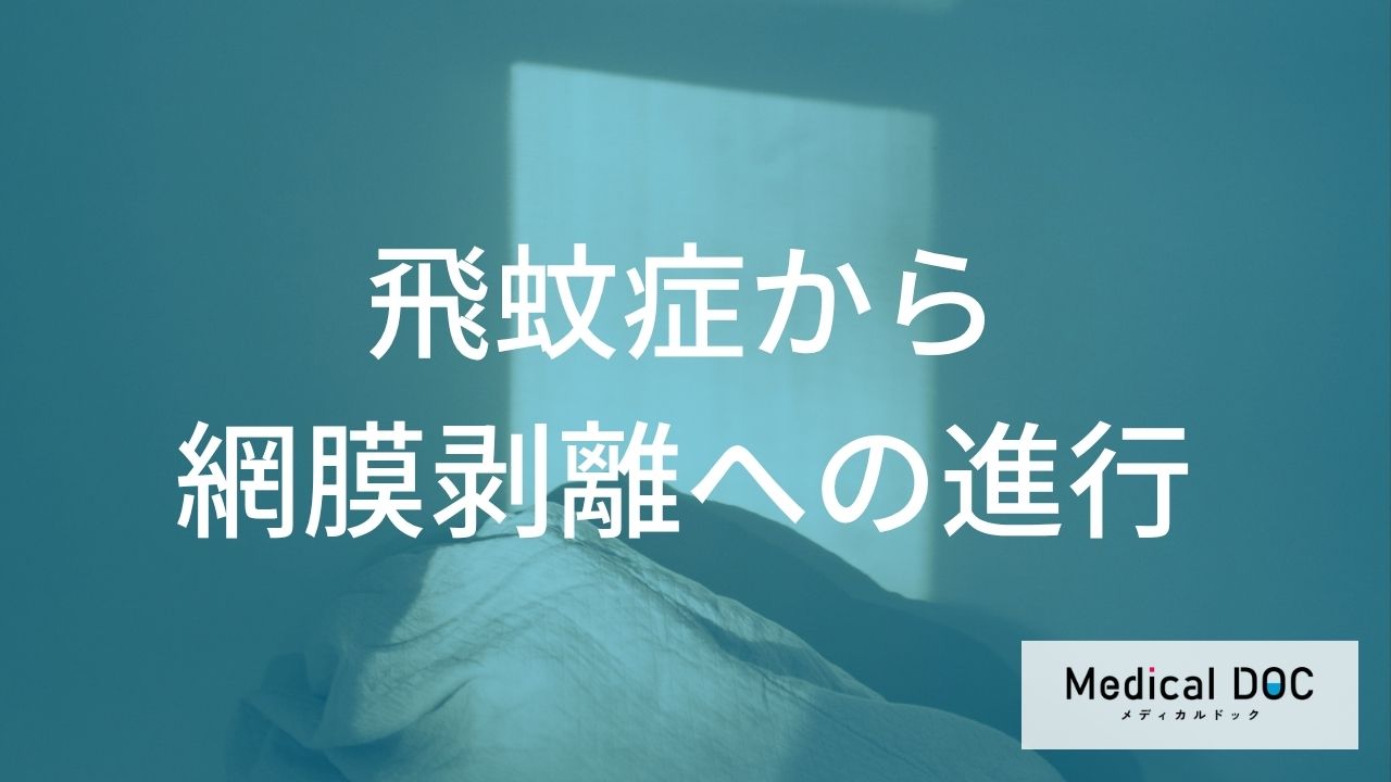 飛蚊症から「網膜剥離」に… 見え方の変化と失明までのカウントダウン