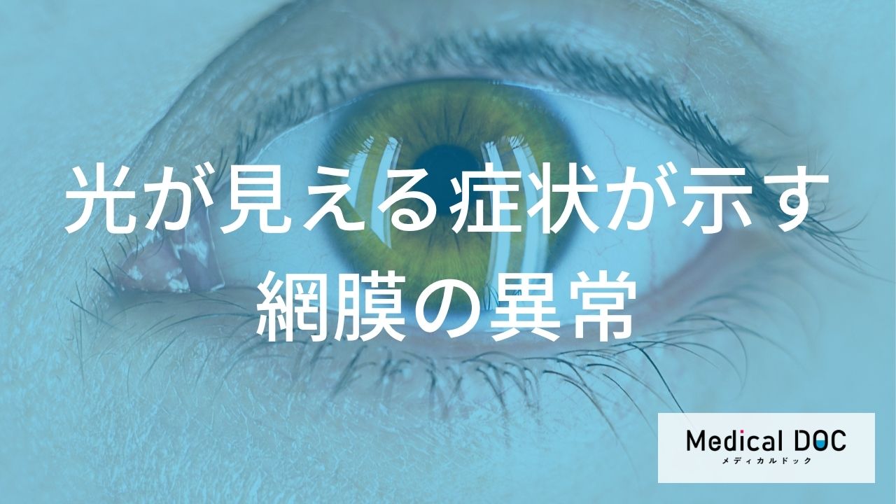 光視症のメカニズム 「網膜剥離」を未然に防ぐための「光」のチェック法とは?