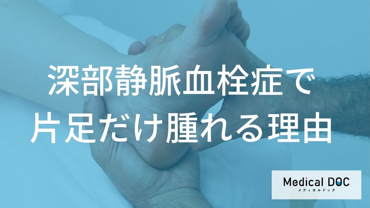 片足だけ腫れる理由とメカニズム