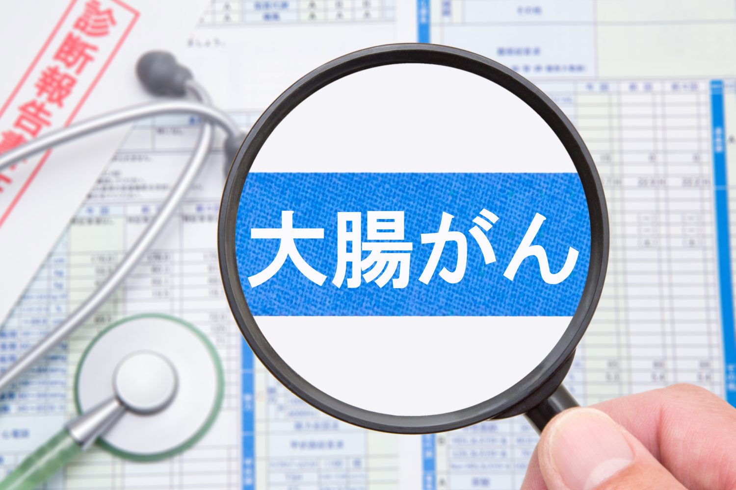 大腸がんとは？