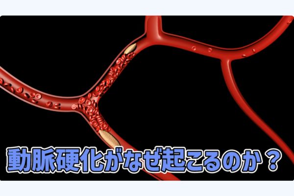  血管を傷つける「ザラメ」と「お粥」？ 動脈硬化の正体とは