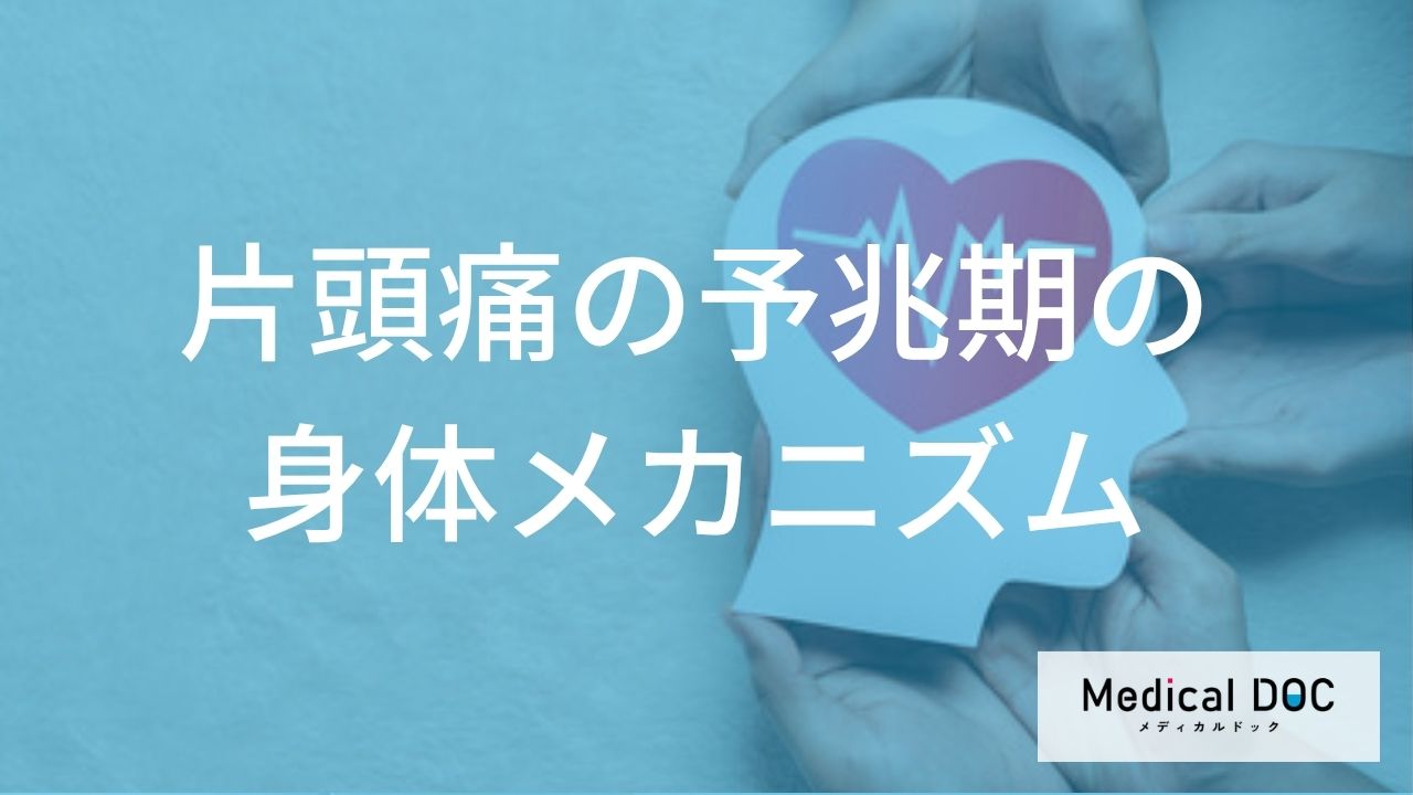 「片頭痛」が起きる前のサインとは？予兆期のメカニズムと見逃さないコツも医師が解説！