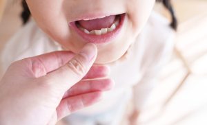 子どもの矯正歯科の選び方は？歯列矯正の種類や初回相談のポイントも解説