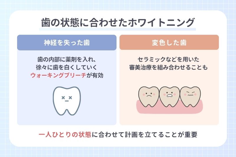 歯の状態に合わせたホワイトニング