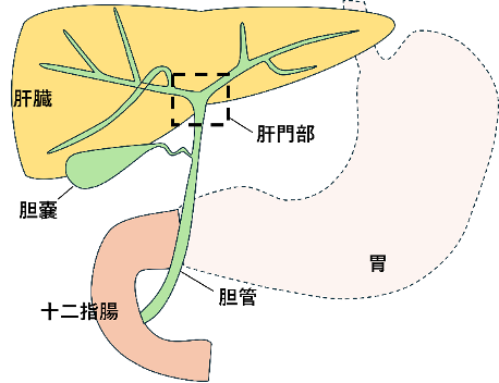 「肝門部胆管がん」とは？
