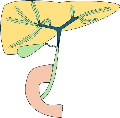 肝門部胆管がんの主な症状_胆管炎
