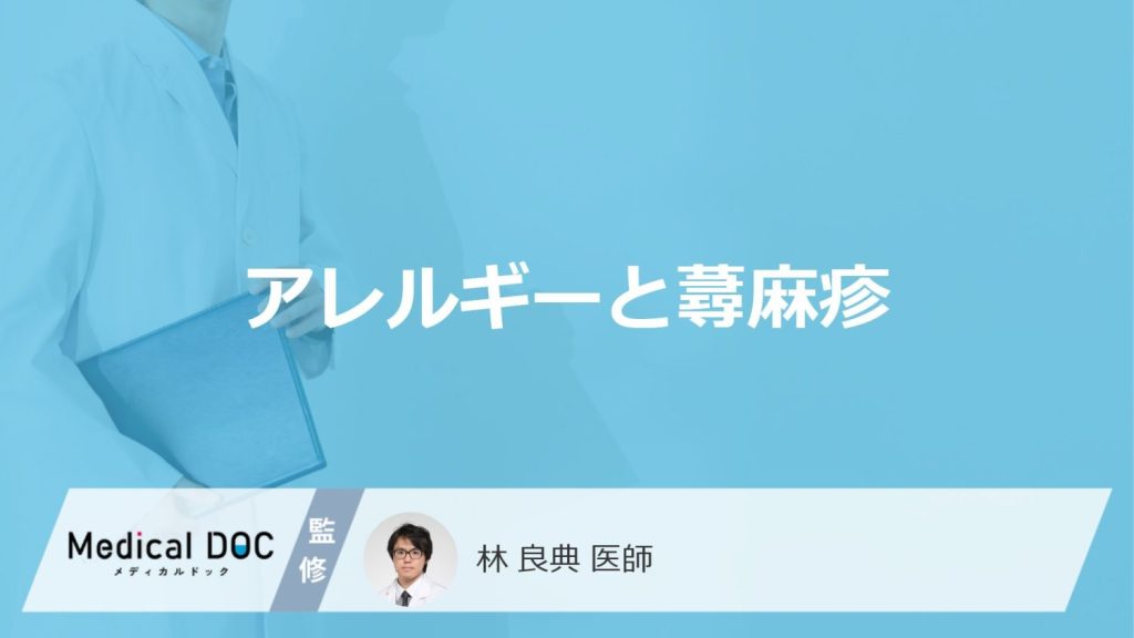「アレルギーによる蕁麻疹」の特徴はご存知ですか？対処法や受診の目安も解説！