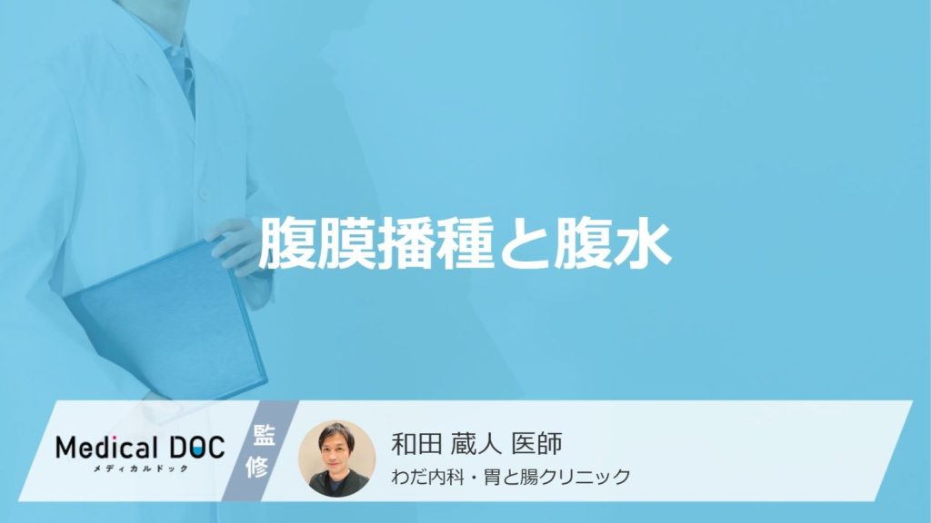 「腹膜播種で腹水」が溜まると起きる”3つの症状”とは？なりやすいがんや余命も医師が解説！