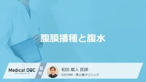 「腹膜播種で腹水」が溜まると起きる”3つの症状”とは？なりやすいがんや余命も医師が解説！
