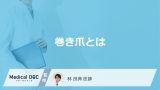 靴だけじゃない？ 巻き爪になりやすい人に共通する「足の指」の意外な状態とは