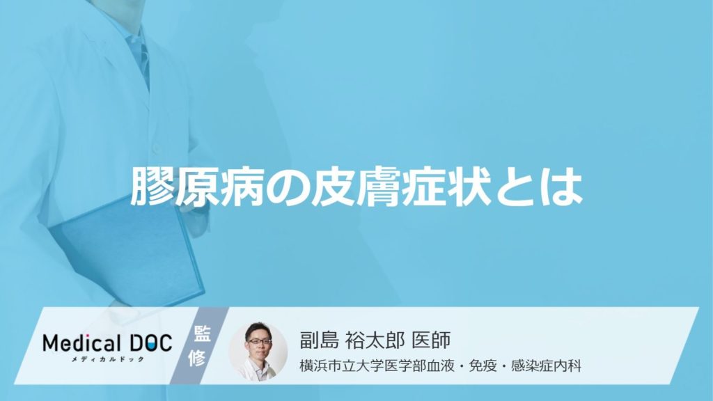 「膠原病」を発症すると「皮膚」にどんな症状が現れるかご存知ですか？【医師監修】