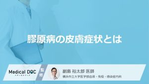 「膠原病」を発症すると「皮膚」にどんな症状が現れるかご存知ですか？【医師監修】