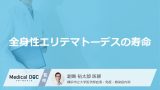 生存率が50%から激変？『全身性エリテマトーデスの寿命』はご存知ですか？【医師監修】