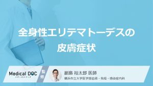 「全身性エリテマトーデス」を発症すると「皮膚」にどんな症状が現れるかご存知ですか？