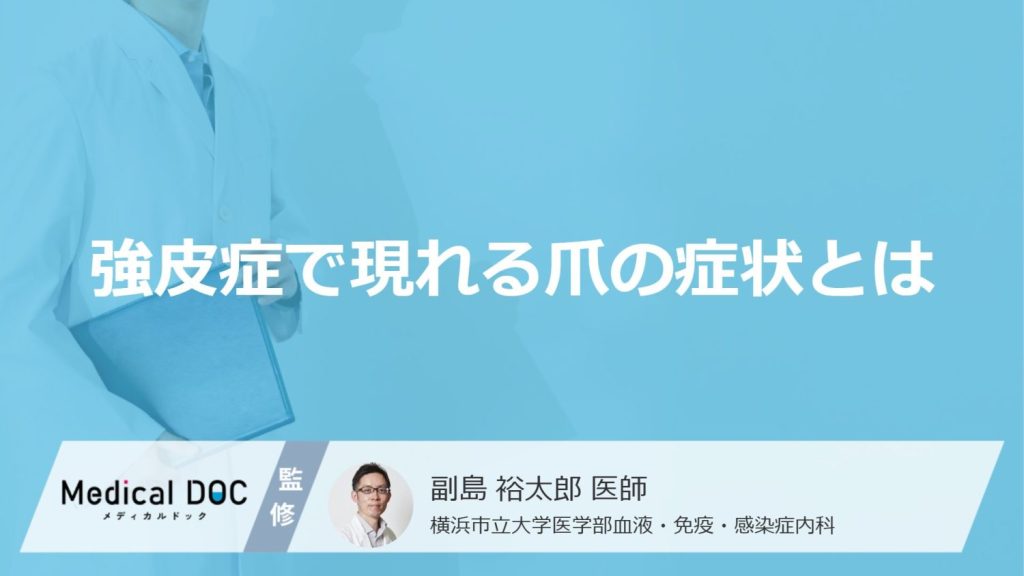 「強皮症」を発症すると「爪」にどんな症状が現れるかご存知ですか？【医師監修】
