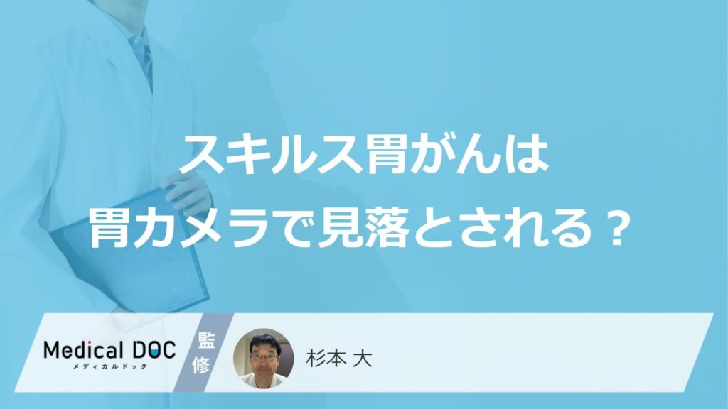 なぜ「スキルス胃がん」は”胃カメラで見落とし”されやすい？早期発見のコツも医師が解説！