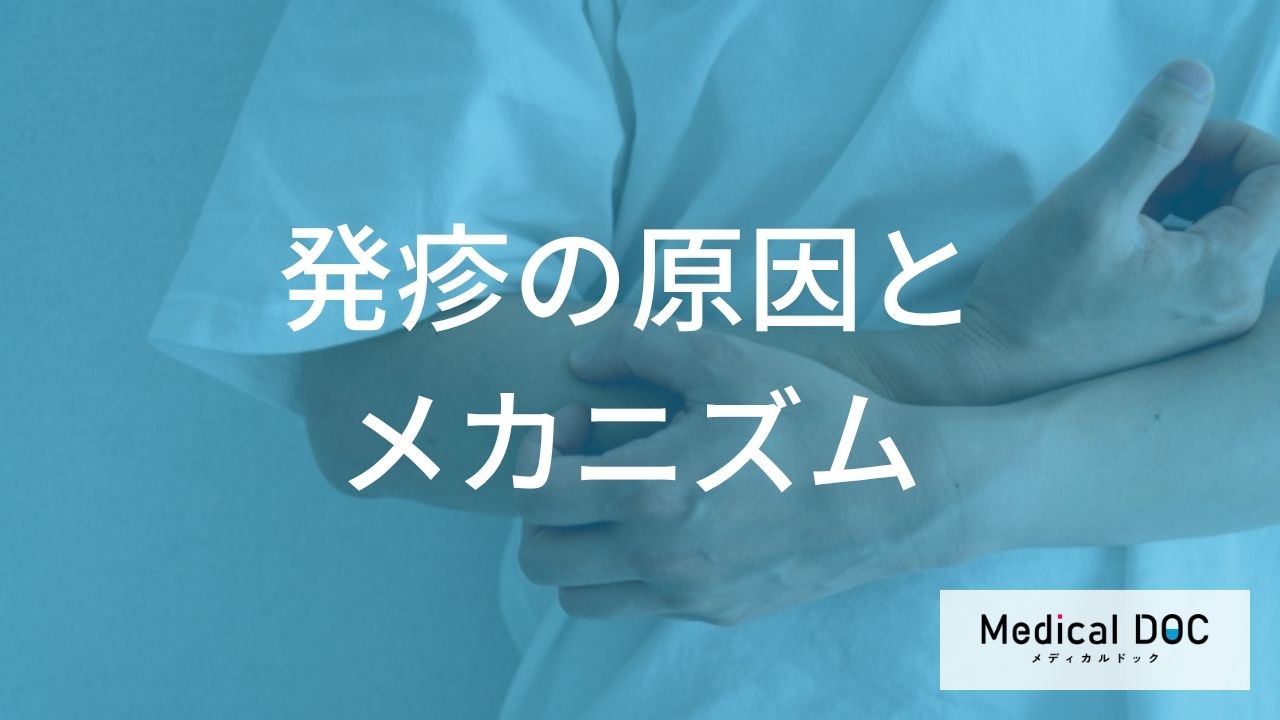 麻疹や水痘、じんま疹など発疹が出る特徴とは？その原因とメカニズムについて【医師解説】