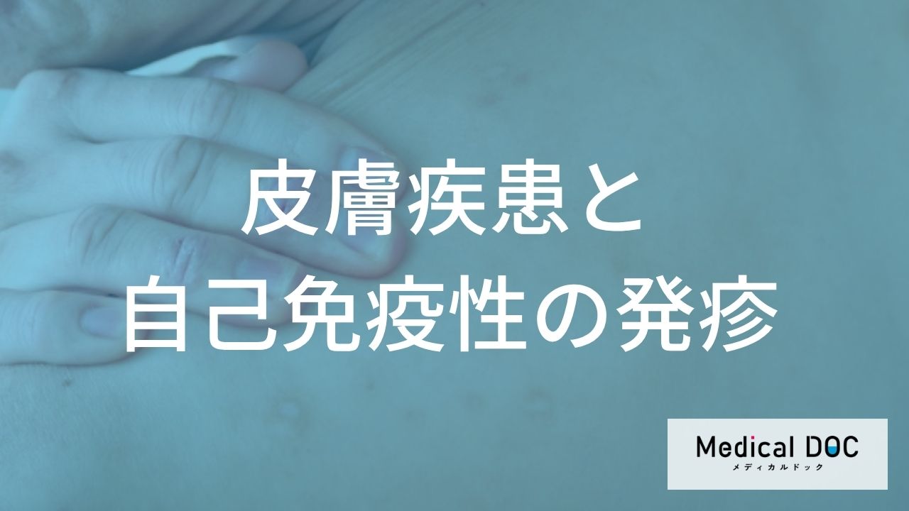 なかなか治らない「発疹」は何のサイン？ 慢性皮膚疾患や自己免疫疾患の特徴【医師解説】