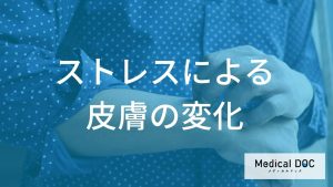 ストレスが引き起こす皮膚の変化