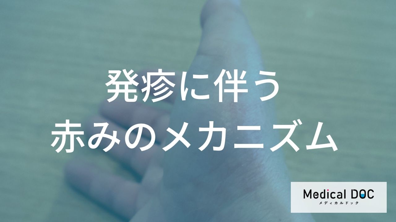発疹に伴う赤みのメカニズムとは？治療の効果と対処法【医師監修】