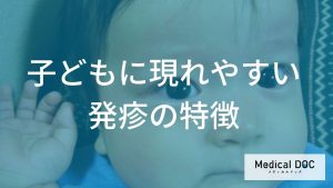 子どもに現れやすい発疹の特徴