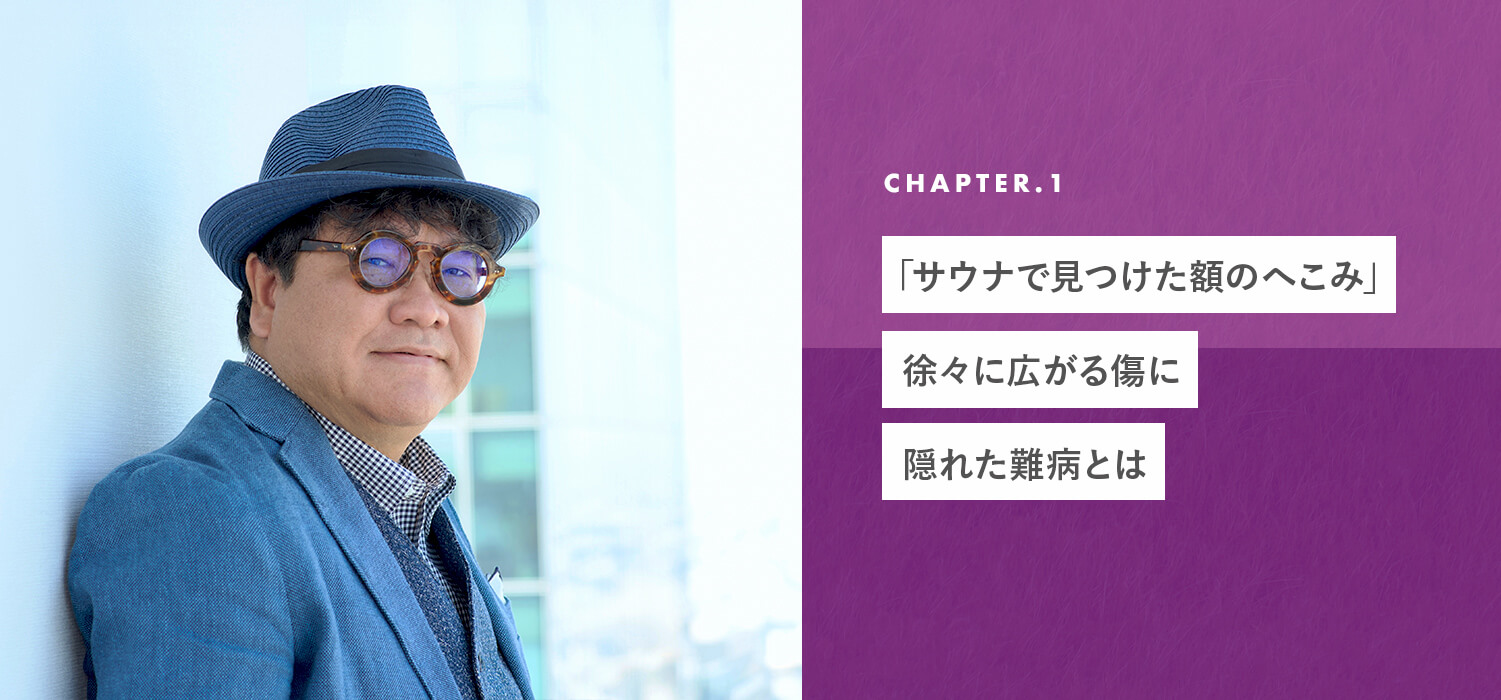 「サウナで見つけた額のへこみ」徐々に広がる傷に隠れた難病とは