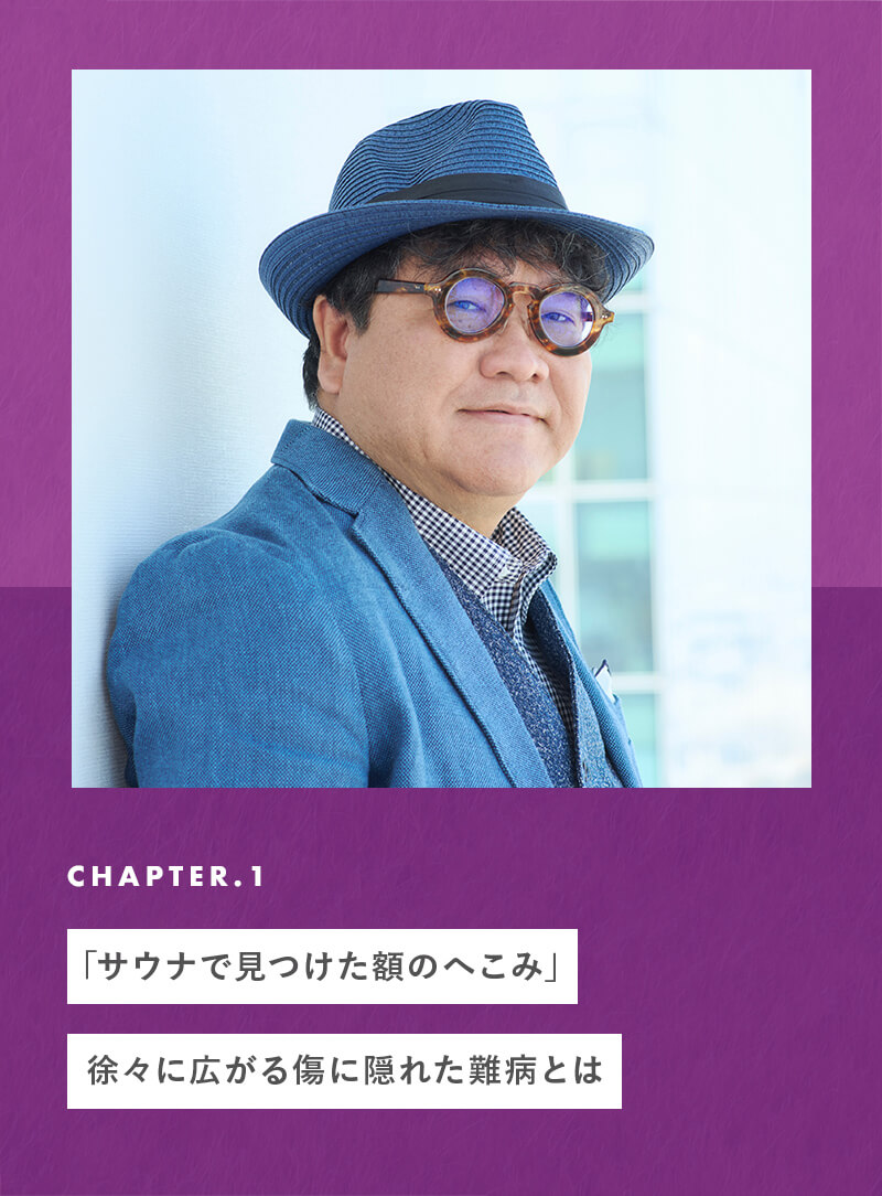 「サウナで見つけた額のへこみ」徐々に広がる傷に隠れた難病とは