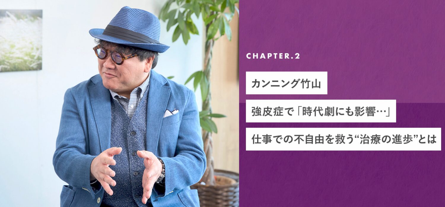 chapter02 カンニング竹山、強皮症で「時代劇にも影響…」仕事での不自由を救う“治療の進歩”とは