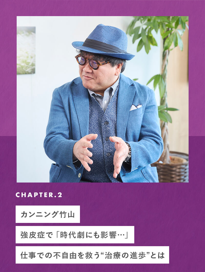 chapter02 カンニング竹山、強皮症で「時代劇にも影響…」仕事での不自由を救う“治療の進歩”とは