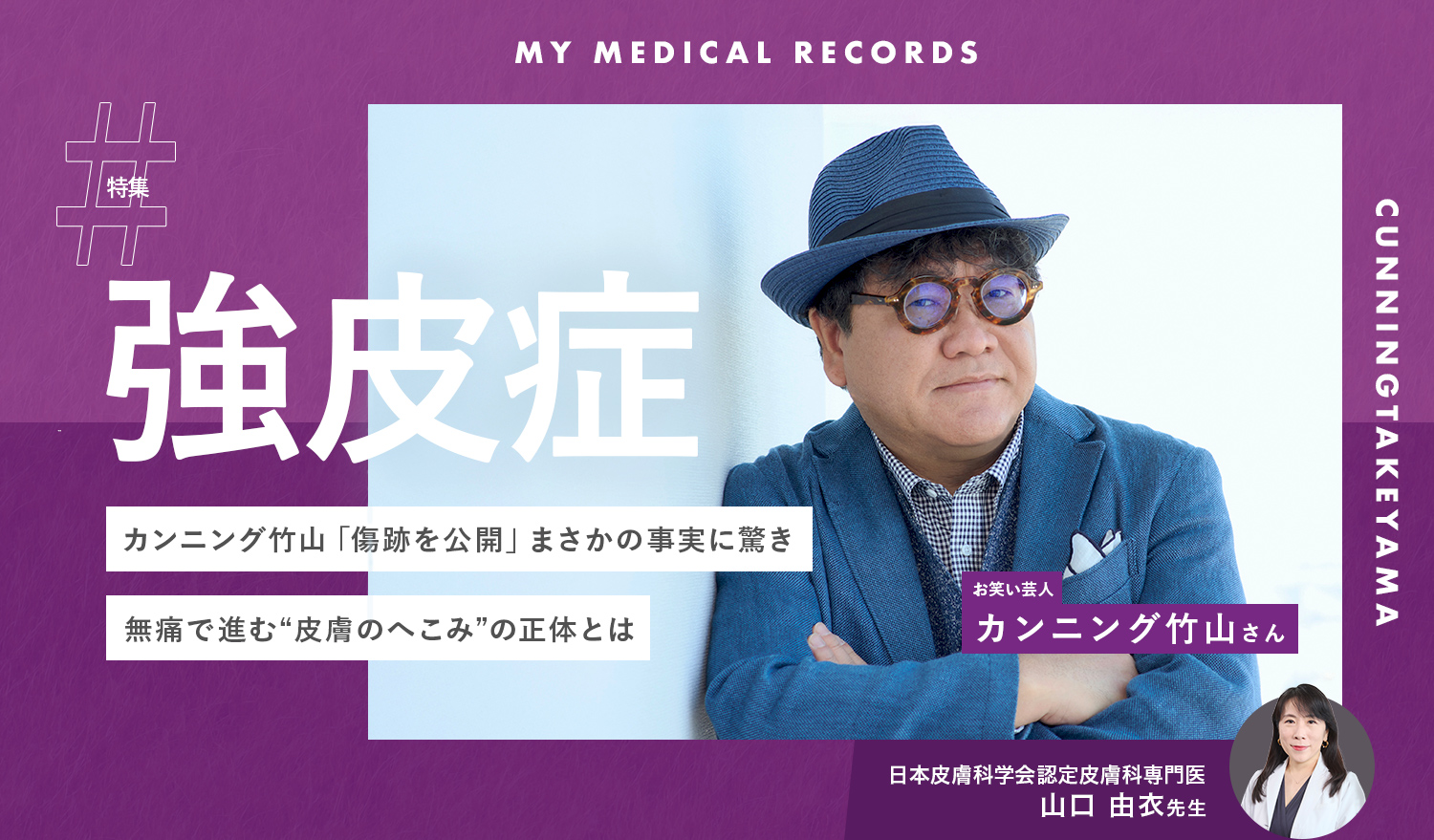 カンニング竹山「傷跡を公開」まさかの事実に驚き。無痛で進む“皮膚のへこみ”の正体とは