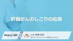 肝臓がんのしこりの位置