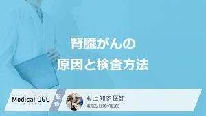 「腎臓がん」になりやすい”2つの原因”はご存じですか？検査法も医師が解説！