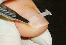 巻き爪矯正院 みのわ整骨院詳細写真2