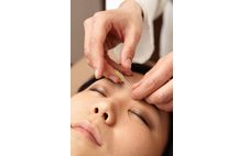 東京α鍼灸整骨院詳細写真2