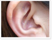 みずこし整骨院詳細写真3