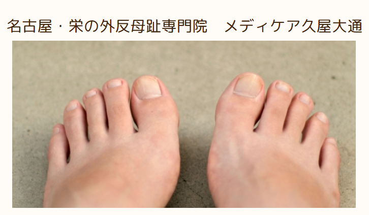 メディケア久屋大通　外反母趾センター