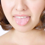 口内炎の症状や原因、治療方法とは