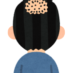 オトコの悩みの代表格！薄毛の悩み「AGA」とは？