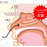 インプラントの埋入方法や手順について詳しく解説